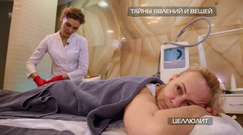 целлюлит